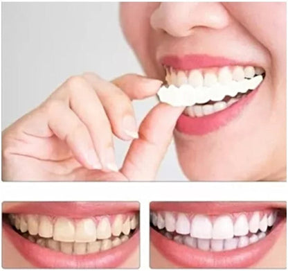 SnapOn Smile - Carillas Dentales Adaptables