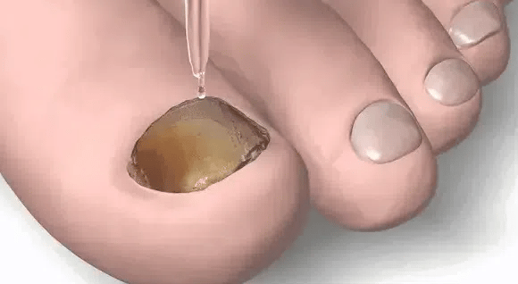 7 Days Endurecedor De Uñas