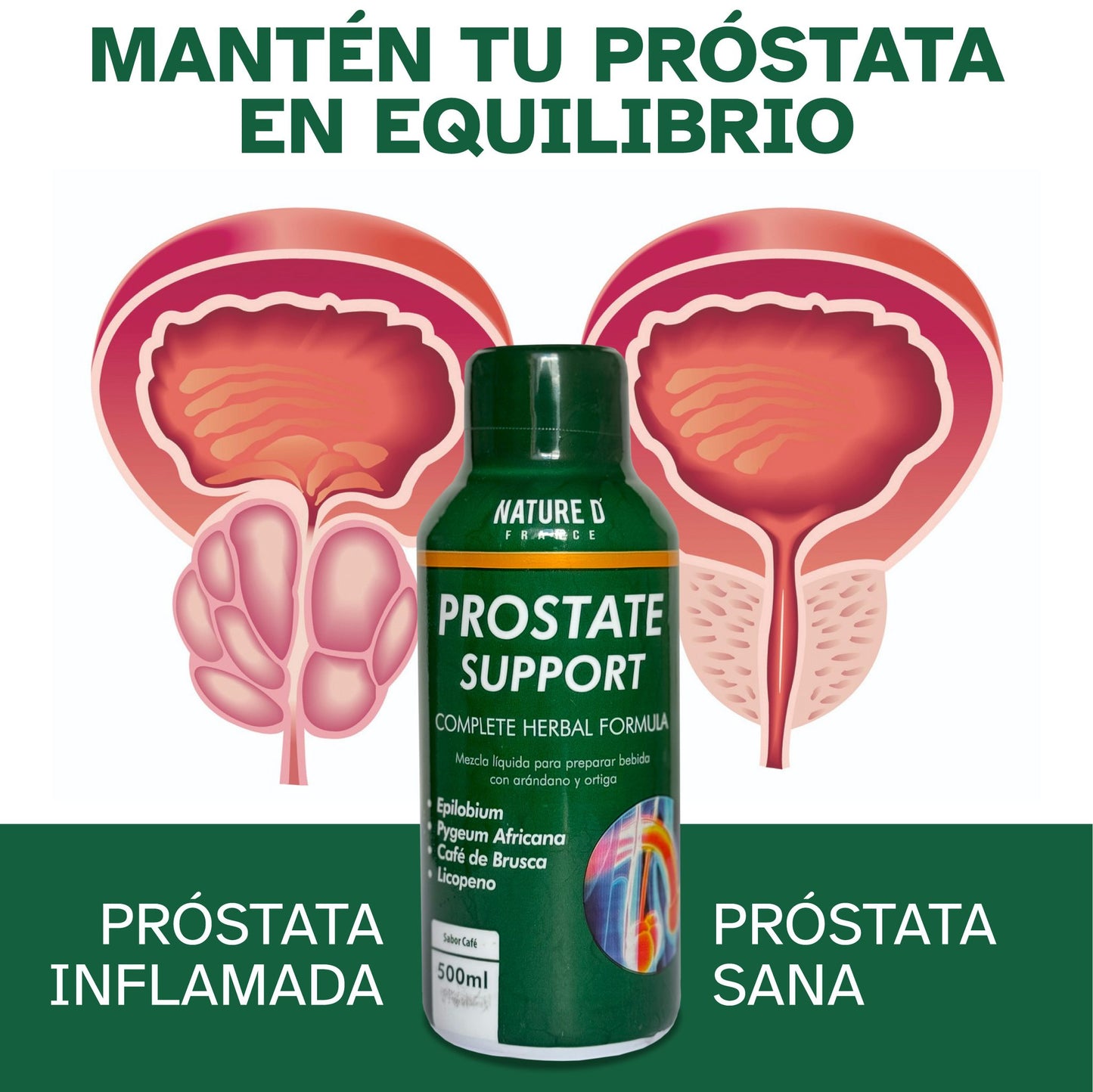 Prostate  Support Jarabe 500 Ml sabor a cafe