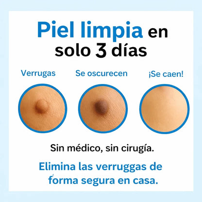 ClearSkin Pro™ – Tratamiento de Precisión