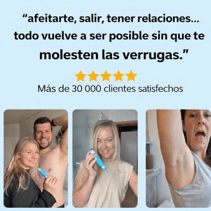ClearSkin Pro™ – Tratamiento de Precisión