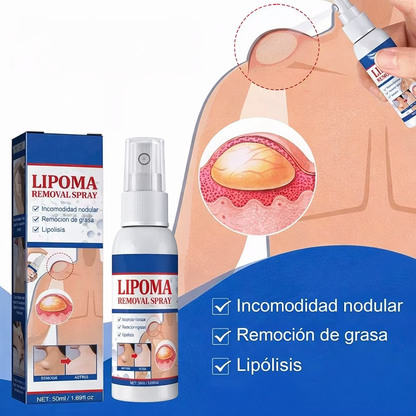 Spray Eliminacion De Lipomas