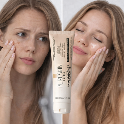 Pureskin® - Crema Facial Anti Manchas