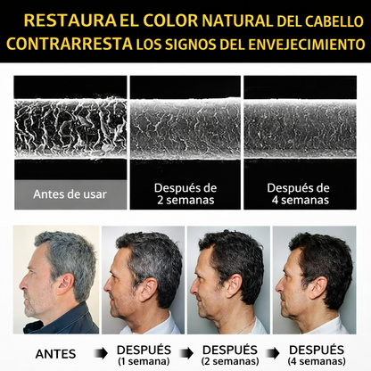 Black Hair Dye® - Shampoo Cubre Canas (250 ml)