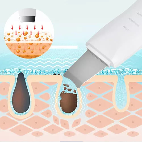 Espátula Ultrasónica de Limpieza Facial Profesional