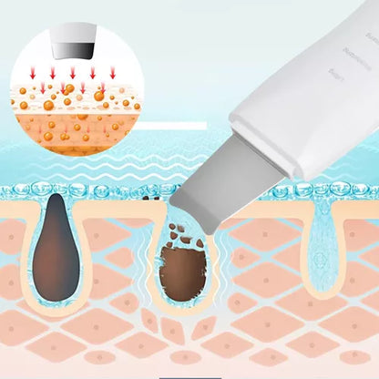 Espátula Ultrasónica de Limpieza Facial Profesional