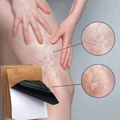 VEINS CARE