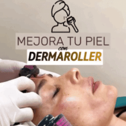 Derma Roller Facial