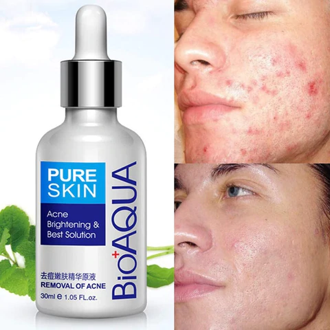 Kit Bioaqua Antiacné Cuidado Diario