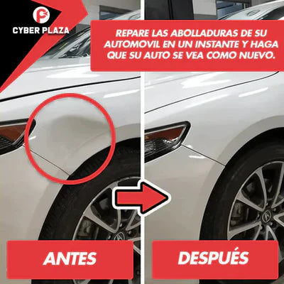DentFix® | Extractor de Abolladuras para Vehículos